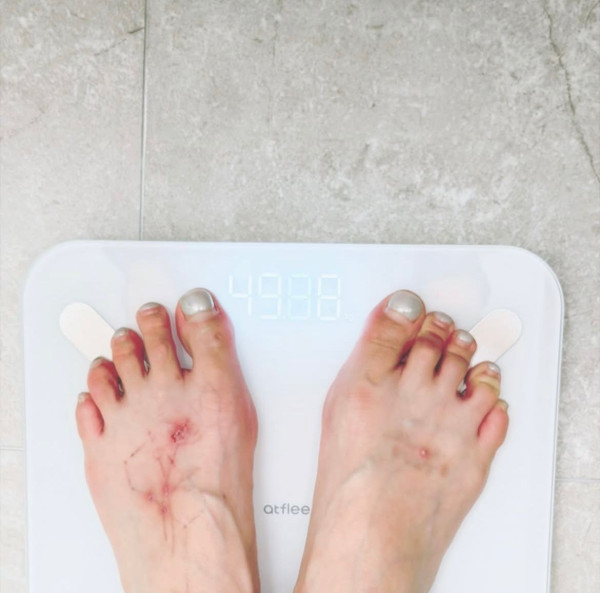 泫雅WATERBOMB台上暈倒！曾揭患長期病月暈12次 醫生提醒2類人最高危！