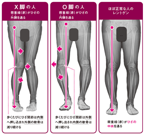 30歲膝蓋就退化？9成港人中招！醫生教一招「無痛甩腳法」助軟骨再生防磨損