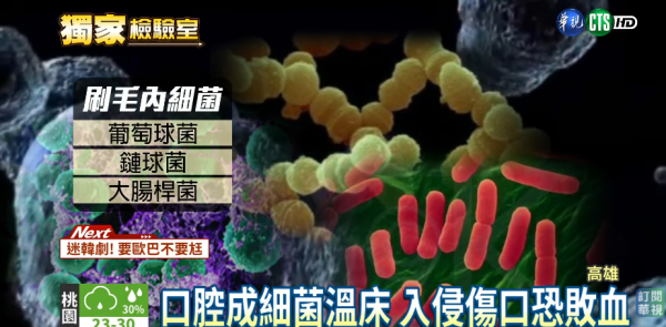 牙刷更換｜牙刷比馬桶污糟55倍？專家警告：1個月不換 細菌恐致敗血症/肺炎
