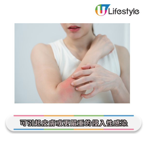 牙刷更換｜牙刷比馬桶污糟55倍？專家警告：1個月不換 細菌恐致敗血症/肺炎