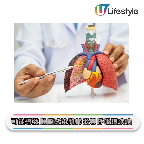 牙刷更換｜牙刷比馬桶污糟55倍？專家警告：1個月不換 細菌恐致敗血症/肺炎