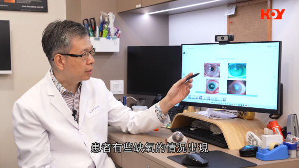 一線搜查｜水貨隱形眼鏡湧入市面！眼科醫生揭2大致盲風險！視光師教一招分真偽行貨