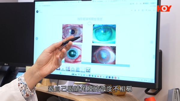 一線搜查｜水貨隱形眼鏡湧入市面！眼科醫生揭2大致盲風險！視光師教一招分真偽行貨