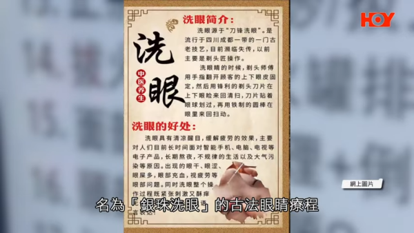 一線搜查｜內地「銀珠洗眼」爆紅！聲稱可助眠、去疲勞？醫生揭3大嚴重風險恐影響視力