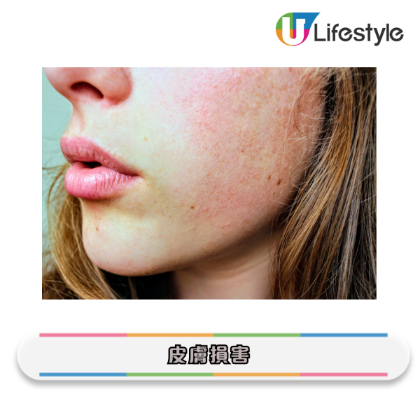 淘寶21款洗面巾含「有毒物質」!洗面恐變爛面毀容?港人常購品牌恐中招