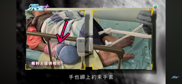 東張西望｜荃灣/元朗安老院變「虐老地獄」婆婆遭掐人中/長期綁腳！內幕曝光令人髮指