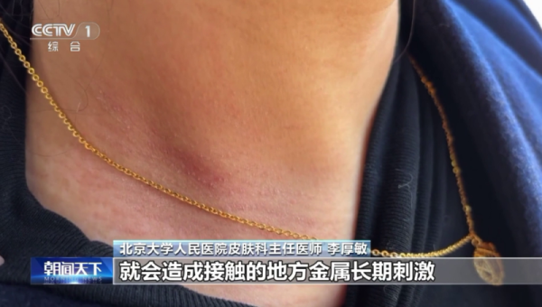 淘寶S925純銀飾物含劇毒合金？一級致癌物超標9000倍 教你3招分真假