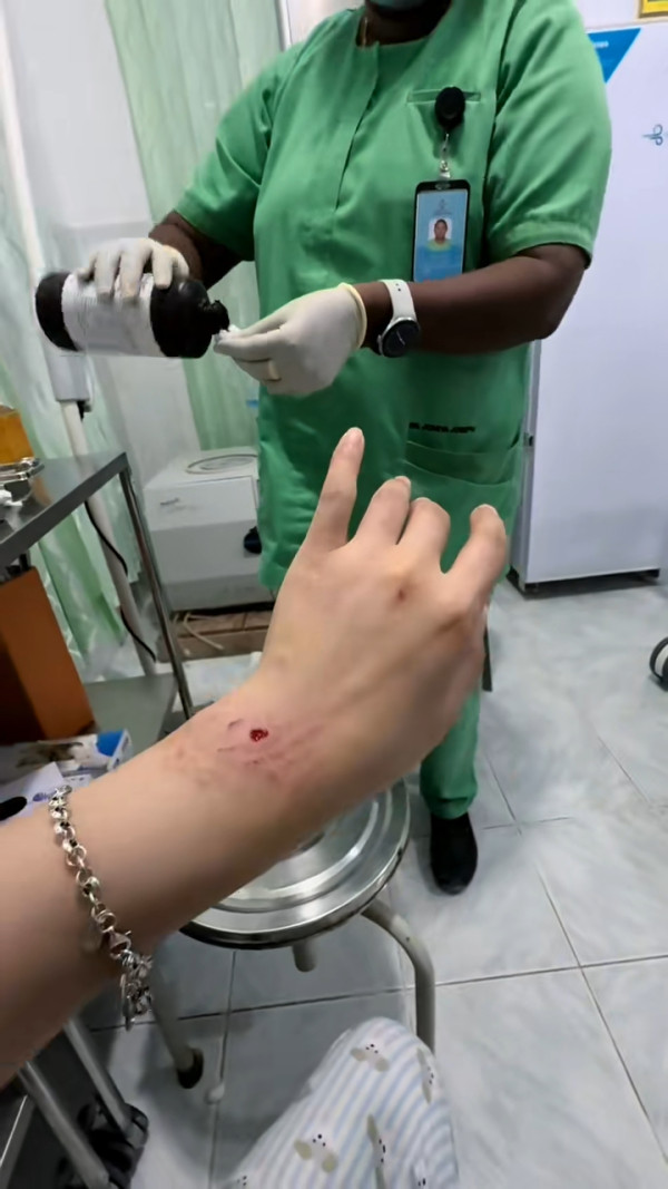 事發一刻曝光！內地女網紅遭鯊魚咬傷感染！ 月經引鯊魚？網民揭真兇係手上一物 