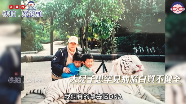 細龜黃一山大仔患先天性罕見病不健全 曾嘆「中獎率」低過六合彩：點解偏偏選中我？