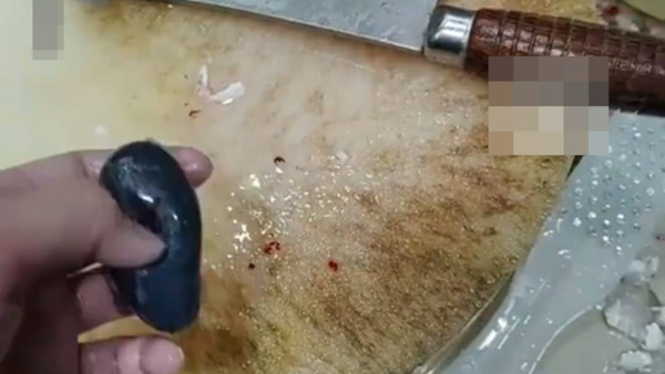 以為補身變洗腎？女子吞魚膽致肝衰竭！醫生警告:毒過砒霜無藥醫／煮熟都冇用