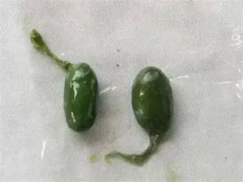 以為補身變洗腎？女子吞魚膽致肝衰竭！醫生警告:毒過砒霜無藥醫／煮熟都冇用