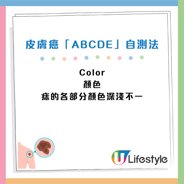 癌症先兆｜30歲女忽視一粒墨變終喪命！5大「隱形殺手」易走漏眼：以為係痔瘡、背痛...