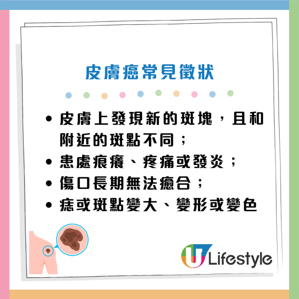 癌症先兆|30歲女忽視一粒墨變終喪命!5大「隱形殺手」易走漏眼:以為係痔瘡、背痛...