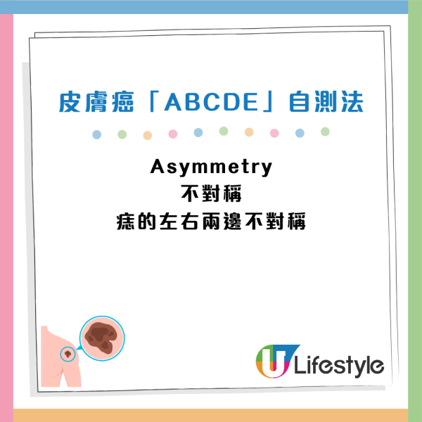 癌症先兆｜30歲女忽視一粒墨變終喪命！5大「隱形殺手」易走漏眼：以為係痔瘡、背痛...