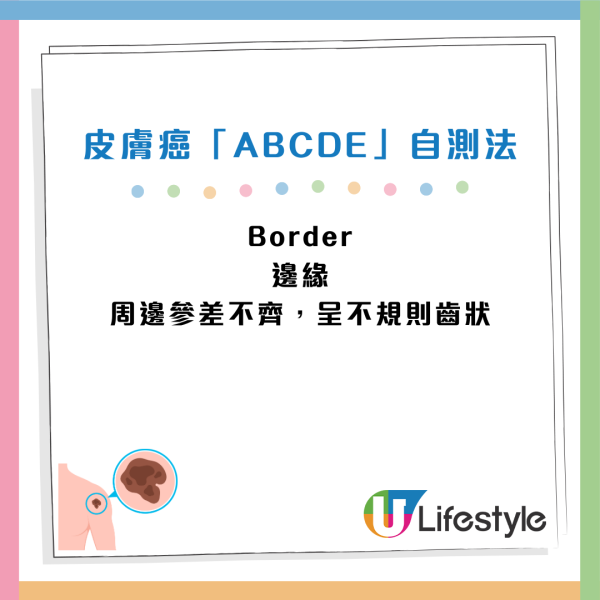 癌症先兆｜30歲女忽視一粒墨變終喪命！5大「隱形殺手」易走漏眼：以為係痔瘡、背痛...