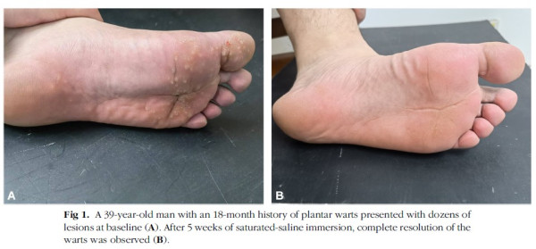 （圖片來源︰FB@皮膚專科 烏惟新醫師）