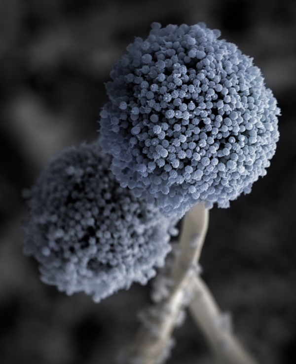 AirPods 幾耐無洗？「耳仔痕」隨時係「發霉生菇」嚴重恐致聽力受損(附清潔教學)