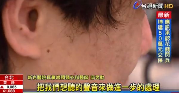 耳機陷阱｜降噪耳機「越靜越傷耳」？28歲男戴整天恐永久聽力受損！醫生揭大腦恐怖「反噬機制」