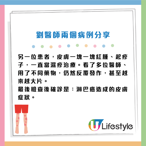 癌症先兆｜皮膚痕以為濕疹？女子半夜「濕身」揭患淋巴癌！醫生：這 4 種痕癢情況極危險