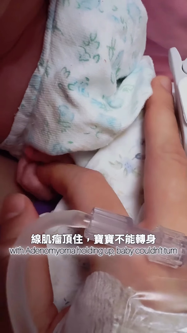 38歲女藝人驚揭簽生死狀生BB過程 因一事被私家醫院拒收！被警告容易流產