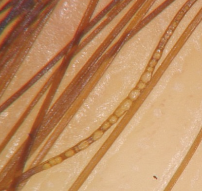 吹頭髮1習慣令髮絲「冒泡」恐致髮絲斷裂!自然風乾都傷頭髮?皮膚科醫師:3大做法最好