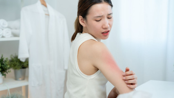 冬天沖熱水涼傷皮膚？醫生警告：超過15分鐘恐誘發皮膚炎　附3招急救止痕