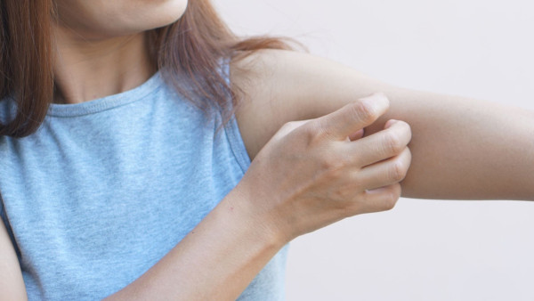 冬天沖熱水涼傷皮膚？醫生警告：超過15分鐘恐誘發皮膚炎　附3招急救止痕