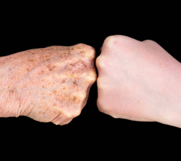 老人斑是內臟衰老警號？75歲名醫親身實測2大飲食去斑法！醫生：單靠護膚品無用