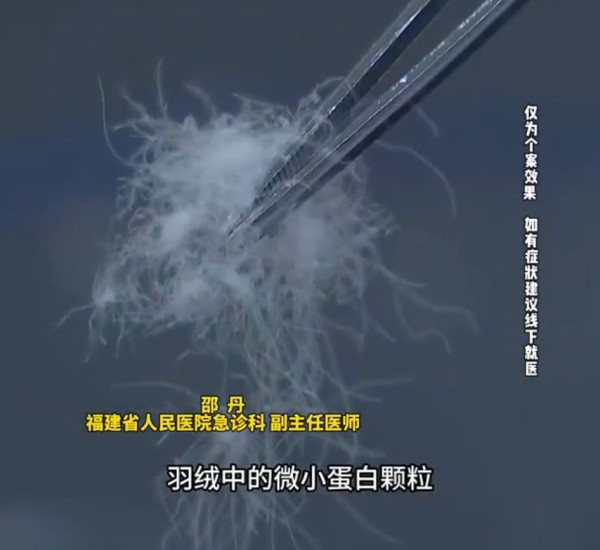 羽絨漏絨驚藏「致命風險」：細絨入肺可致呼吸衰竭 嚴重恐喪命！