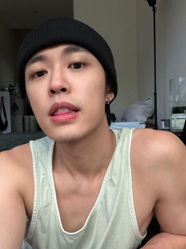 31歲男藝人IG晒恐怖燒傷驚見傷勢嚴重！佈滿血痕險毀容僅留一字惹網民擔心