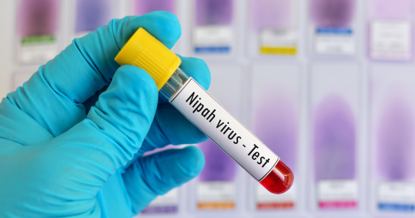 尼帕病毒Q&A會否傳入香港？致死率75%暫無藥醫、印度爆發5宗確診！一文看清病徵及預防方法