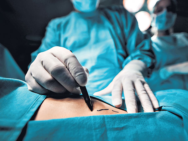 高薪「悶工」｜12. 麻醉護士 Nurse anesthetists。圖片來源：HKET圖庫