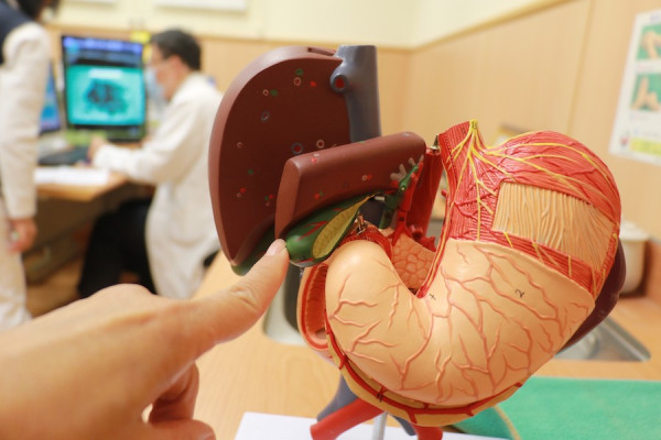 43歲男愛吃2物養出5000顆膽結石！膽囊比正常大1倍險炸裂／曾以為胃病險誤診(附症狀自測)