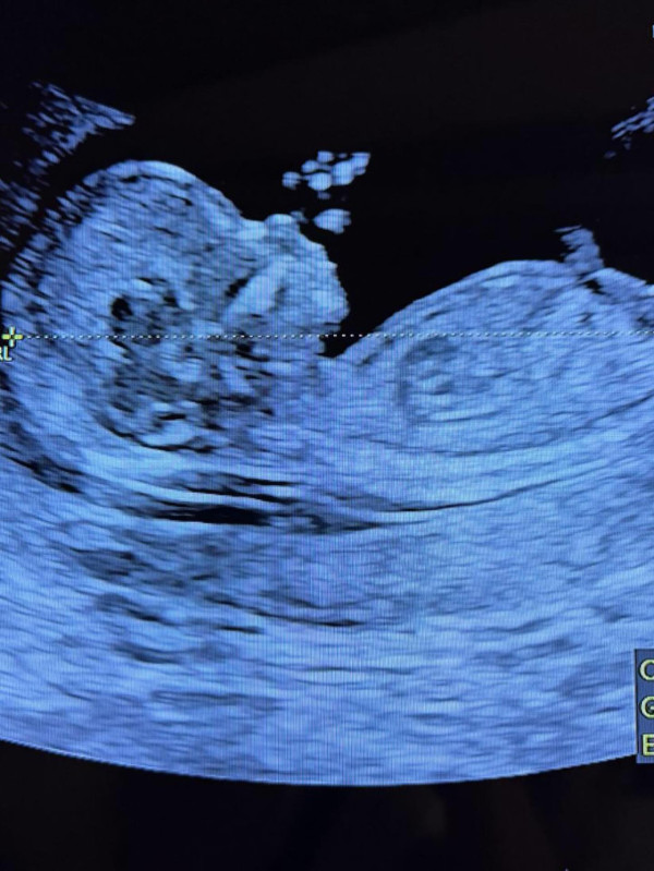 30歲TVB駙馬宣布老婆懷孕喜訊!雙喜臨門晒超聲波相:身份轉變得太快