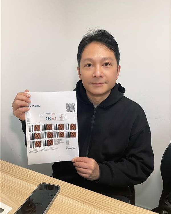 昔日童星「波仔」身體脹爆變肥大叔 驚揭體重飆至180磅︰我有事個女點算？