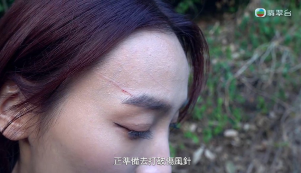 東張女神黎寬怡追訪變態裸男險毀容！鐵網刮面現長血痕傷勢曝光需打破傷風