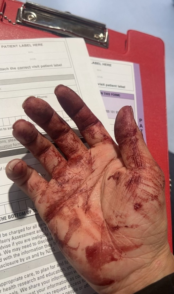 來源：新西蘭中文先驅、抖音