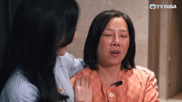 「御用師奶」黃梓瑋醫美後最終樣貌曝光 修復成功被大讚後生10年：整完似黎姿！