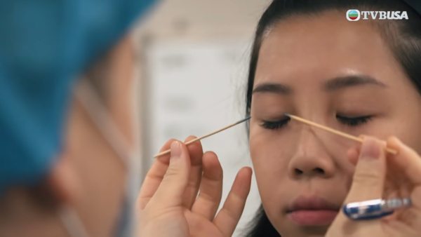 醫美直擊｜資深綠葉黃梓瑋決心開刀割雙眼皮 手術前攬實何依婷激動爆喊：好驚呀