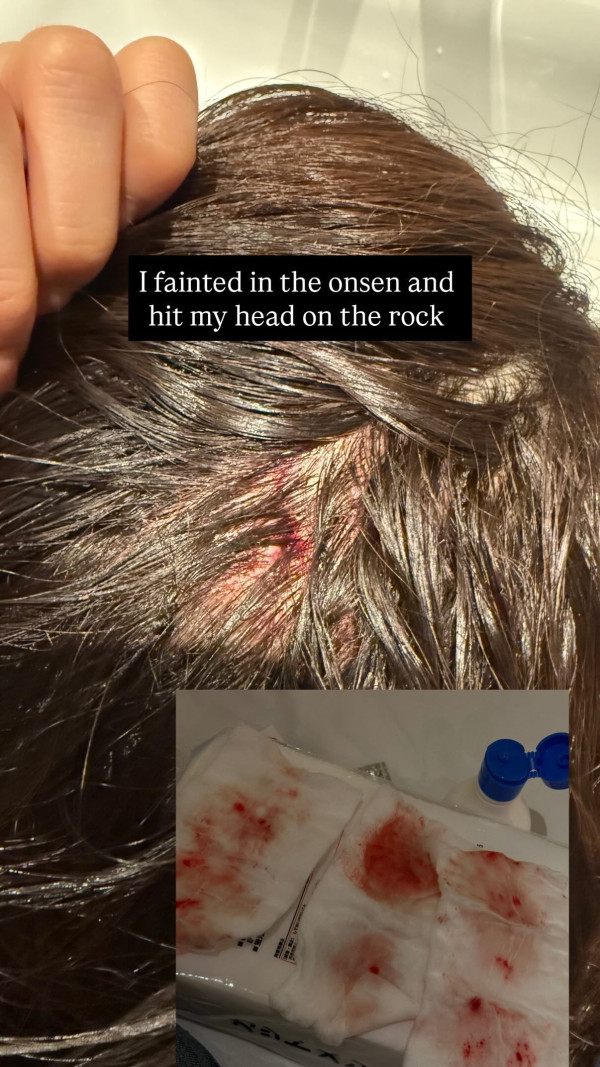 圖片:黃婉恩IG 圖片:黃婉恩IG