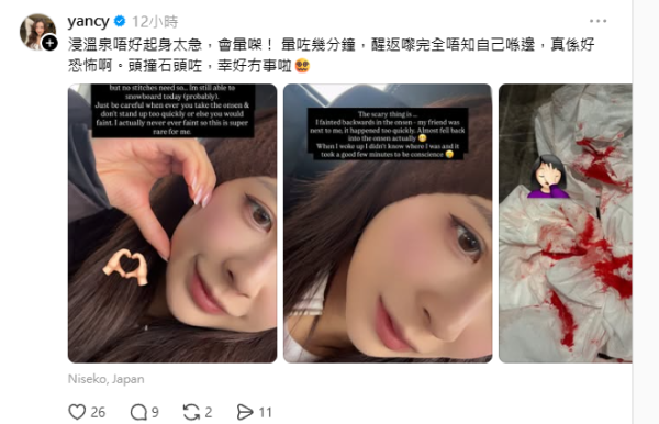 圖片:黃婉恩IG 圖片:黃婉恩IG