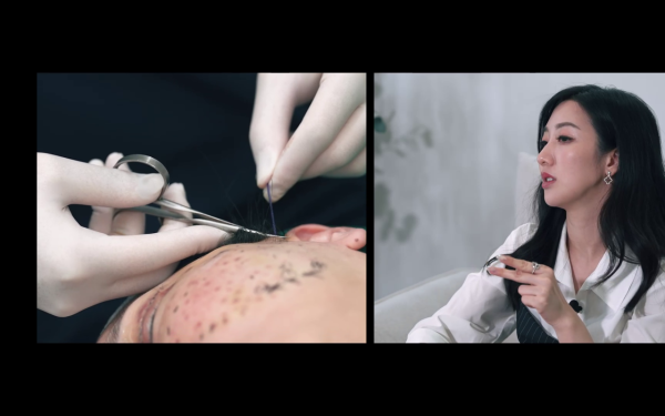 57歲御用師奶驚爆整容失敗！捱痛狂打14針即時回春10年！前後對比極明顯震驚全場 