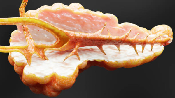 28歲男突發胰腺炎劇痛送院搶救！抽血驚見「豬油血」險死／醫生：全因愛吃3物...