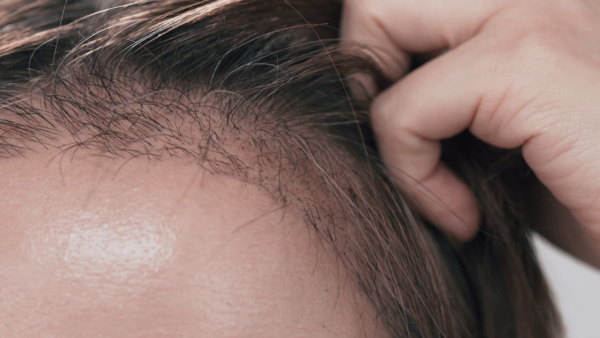 57歲御用師奶黃梓瑋終極醫美成效曝光 最後衝刺溶脂點滴抗擊「甲組腿」煥然一新