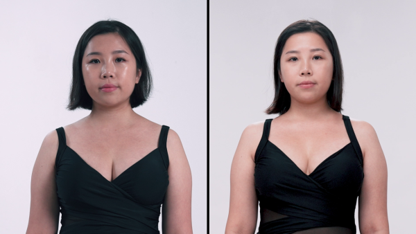 57歲御用師奶黃梓瑋終極醫美成效曝光 最後衝刺溶脂點滴抗擊「甲組腿」煥然一新