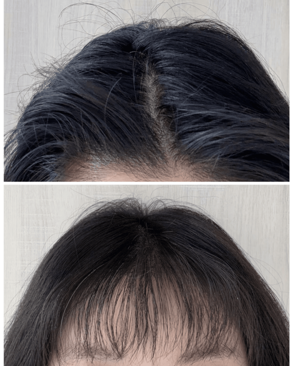 【日本藥妝2026】網民力推必買Top 10好物推介!熱銷清單:爆紅護眼神器/頸紋霜/懶人痠痛膏