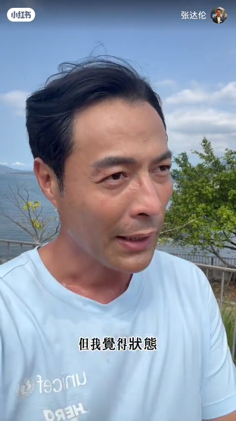 TVB離巢男星驚揭面癱7年左臉失控！後遺症連水都飲唔到？堅持拍劇零破綻惹震驚