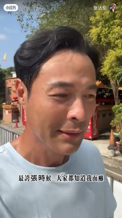 TVB離巢男星驚揭面癱7年左臉失控！後遺症連水都飲唔到？堅持拍劇零破綻惹震驚