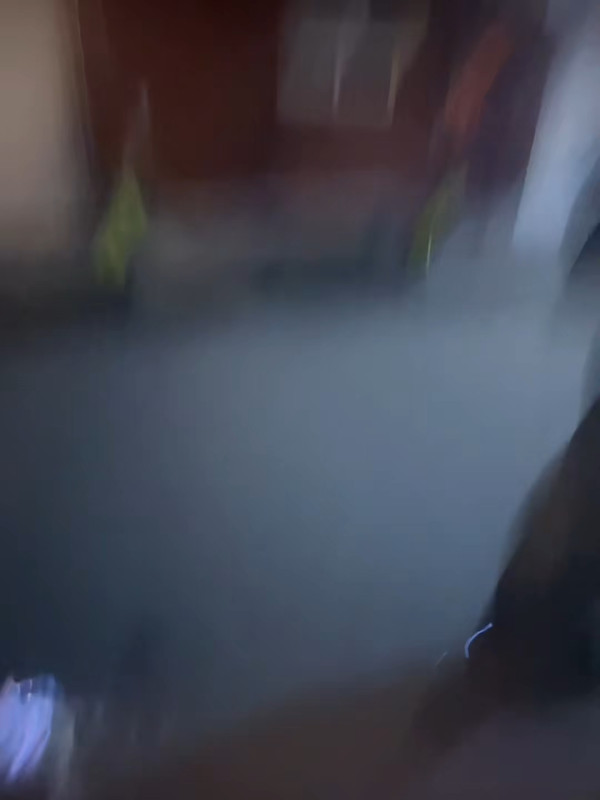 26歲女藝人跟風玩噴火蛋糕慘遭烈焰焚面！96度酒精回火險毀容 怒轟網紅濾鏡害人