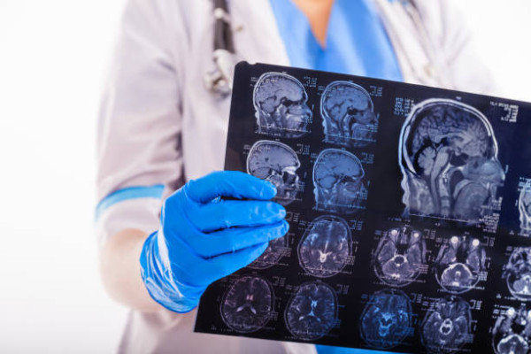 以為普通鼻敏感？醫生警告1種清水鼻涕極危險！隨時是腦液流出3類人最高危